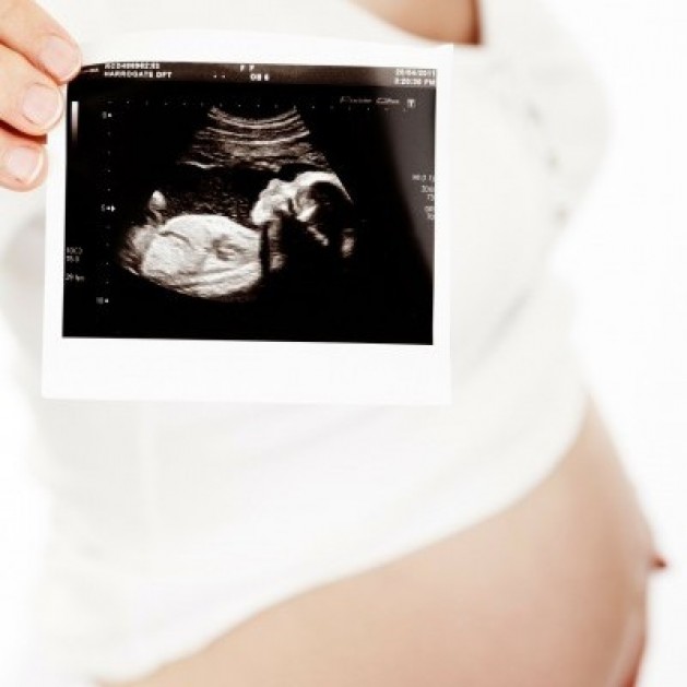 Orientações da Dra.Laurinelle Pio de Melo (Ginecologia e Obstetrícia), sobre Pré-Natal